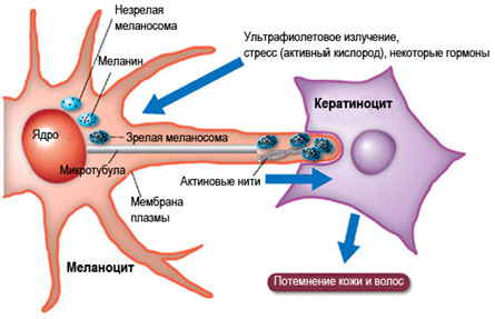 Меланома кожи лечение Меланома лечение