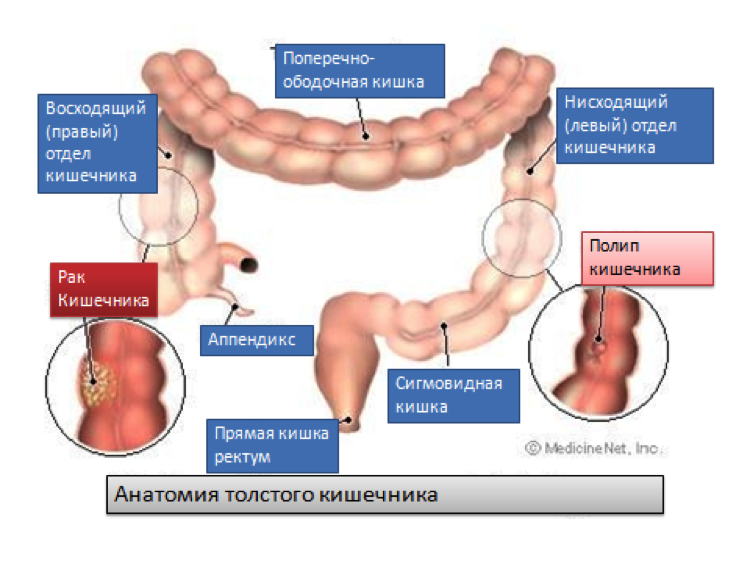 Онкология кишечника Лечение рака толстой кишки
